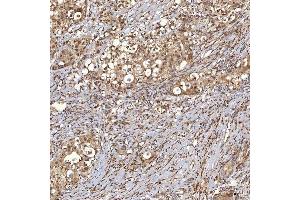 IHC analysis of Sm-D3/SNRPD3 using anti-Sm-D3/SNRPD3 antibody (ABIN7598952). (SNRPD3 抗体  (AA 1-112))