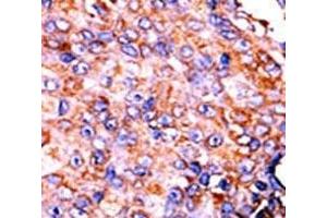 Immunohistochemistry (IHC) image for anti-Signal Transducer and Activator of Transcription 3 (Acute-Phase Response Factor) (STAT3) (pSer727) antibody (ABIN3032570)