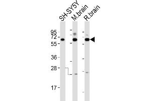 All lanes : Anti-DPYSL5 Antibody (C-term) at 1:2000 dilution Lane 1: SH-SY5Y whole cell lysates Lane 2: mouse brain lysates Lane 3: rat brain lysates Lysates/proteins at 20 μg per lane. (DPYSL5 抗体  (C-Term))