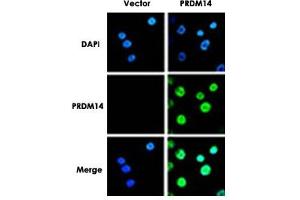 Immunofluorescence analysis of PRDM14 in breast cancer cells. (PRDM14 抗体  (N-Term))