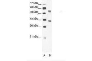 Image no. 1 for anti-RRN3 RNA Polymerase I Transcription Factor (RRN3) (AA 331-380) antibody (ABIN202852) (RRN3 抗体  (AA 331-380))
