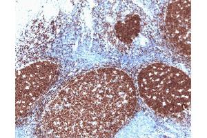 Pax-5 (clone 24) staining on human tonsil. (PAX5 抗体  (AA 151-306))