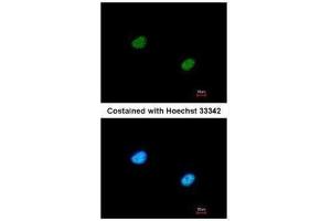 ICC/IF Image Immunofluorescence analysis of paraformaldehyde-fixed A431, using RBBP5, antibody at 1:200 dilution. (RBBP5 抗体  (Center))