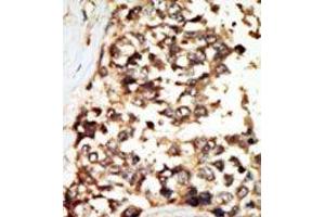 Image no. 2 for anti-Protein Kinase D2 (PKD2) (C-Term) antibody (ABIN360330) (PKD2 抗体  (C-Term))