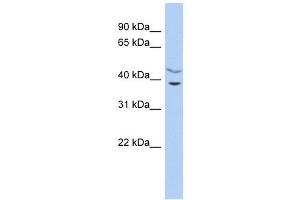 C11ORF77 antibody used at 1 ug/ml to detect target protein. (HARBI1 抗体  (Middle Region))