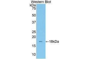 Western blot analysis of the recombinant protein. (TCF20 抗体  (AA 1656-1792))