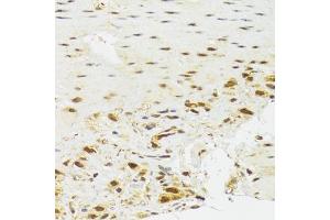 Immunohistochemistry of paraffin-embedded human stomach using EFTUD2 Antibody (ABIN5974236) at dilution of 1/100 (40x lens). (EFTUD2 抗体)