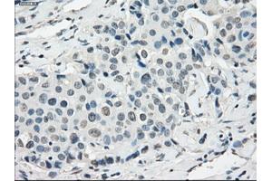 Image no. 1 for anti-Synovial Sarcoma, X Breakpoint 2 (SSX2) antibody (ABIN1501161) (SSX2 抗体)