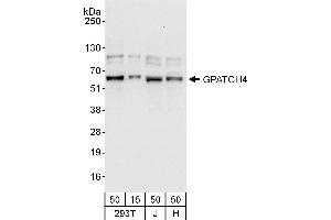 anti-G Patch Domain Containing 4 (GPATCH4) (AA 396-446) antibody