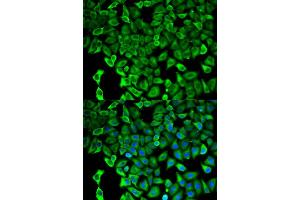 Immunofluorescence (IF) image for anti-Proteasome (Prosome, Macropain) 26S Subunit, Non-ATPase, 2 (PSMD2) antibody (ABIN1874389) (PSMD2 抗体)