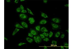 Immunofluorescence of monoclonal antibody to HARS on HeLa cell. (HARS1/Jo-1 抗体  (AA 1-96))