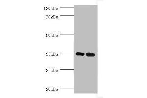 Western blot All lanes: MAGEA6 antibody at 7 μg/mL Lane 1: Rat brain tissue Lane 2: Rat gonad tissue Secondary Goat polyclonal to rabbit IgG at 1/10000 dilution Predicted band size: 35 kDa Observed band size: 35 kDa (MAGEA6 抗体  (AA 75-314))