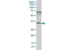 MYOZ1 monoclonal antibody (M05A), clone 1E8. (Myozenin 1 抗体  (AA 200-298))
