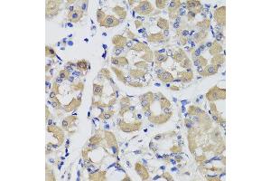 Immunohistochemistry of paraffin-embedded human gastric using PSPH antibody at dilution of 1:100 (x40 lens). (PSPH 抗体)