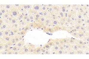 Detection of C9 in Mouse Liver Tissue using Polyclonal Antibody to Complement Component 9 (C9)