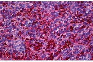 Human Spleen: Formalin-Fixed, Paraffin-Embedded (FFPE) (XCL1 抗体  (AA 22-114))