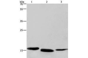 Western Blot analysis of Human kidney cancer, Mouse liver and Human bladder carcinoma tissue using Cytochrome b5 Polyclonal Antibody at dilution of 1:300 (Cytochrome b5 (CYTB5) 抗体)