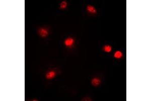Immunofluorescent analysis of CBP staining in HeLa cells. (CBP 抗体  (Center))