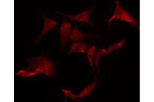 ABIN6275305 staining HeLa by IF/ICC. (CHRNA10 抗体  (C-Term))