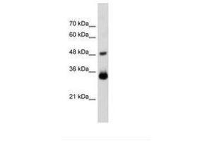 Image no. 1 for anti-Homeobox C9 (HOXC9) (AA 151-200) antibody (ABIN203517)
