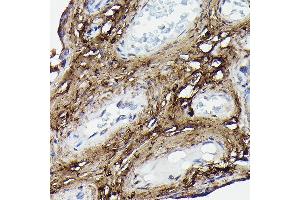 Immunohistochemistry (IHC) image for anti-Collagen, Type I, alpha 2 (COL1A2) (AA 500-600) antibody (ABIN6138839)