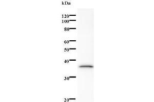 Western Blotting (WB) image for anti-SUMO1 Activating Enzyme Subunit 1 (SAE1) antibody (ABIN931206) (SAE1 抗体)