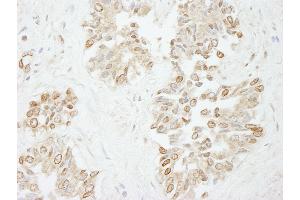 anti-Polymerase (DNA Directed), lambda (POLL) (AA 525-575) antibody