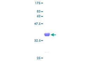 SNRPE Protein (AA 1-92) (GST tag)