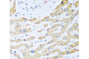 Ferredoxin Reductase 抗体