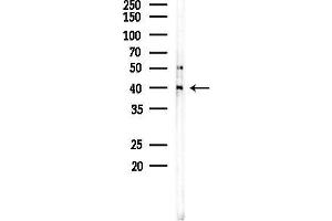 anti-Vacuolar Protein Sorting 72 Homolog (S. Cerevisiae) (VPS72) (Internal Region) antibody