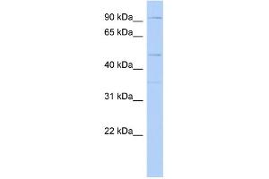 WB Suggested Anti-DPY19L2 Antibody Titration: 0. (DPY19L2 抗体  (Middle Region))