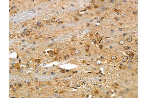 ABIN6257883 and ABIN6275262 at 1/100 staining Rat brain tissue by IHC-P. (MYOM2 抗体  (Internal Region))