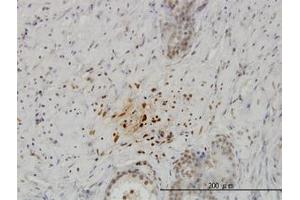 Image no. 1 for anti-Kisspeptin (KISS1) (AA 46-146) antibody (ABIN598771) (KISS1 抗体  (AA 46-146))