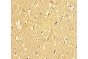 Immunohistochemistry of paraffin-embedded human brain tissue using ABIN7158695 at dilution of 1:100 (KDM4A 抗体  (AA 127-364))