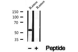 Western blot analysis of extracts of Ramos cells, using Phospho-CD79A (Tyr182) Antibody.