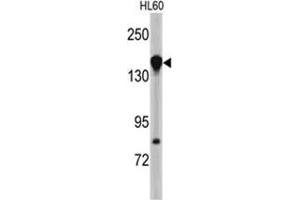Western blot analysis of NUP155 antibody (N-term) in HL60 cell line lysates (35ug/lane). (NUP155 抗体  (N-Term))