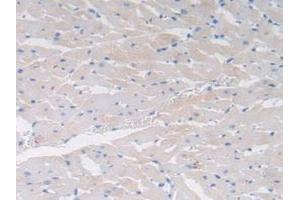 Detection of CCK in Rat Heart Tissue using Polyclonal Antibody to Cholecystokinin (CCK) (Cholecystokinin 抗体  (AA 1-115))