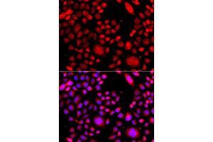Immunofluorescence analysis of A549 cell using RAC3 antibody. (RAC3 抗体)