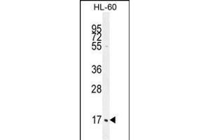 C1QC Antibody (Center) (ABIN655873 and ABIN2845277) western blot analysis in HL-60 cell line lysates (35 μg/lane). (C1QC 抗体  (AA 93-120))