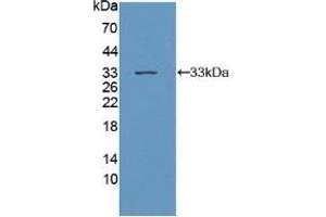 Detection of Recombinant gp130, Mouse using Polyclonal Antibody to Glycoprotein 130 (gp130) (CD130/gp130 抗体  (AA 238-500))