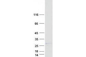 Western Blotting (WB) image for Ribonuclease, RNase A Family, 1 (Pancreatic) (RNASE1) (Transcript Variant 1) protein (Myc-DYKDDDDK Tag) (ABIN2730986)