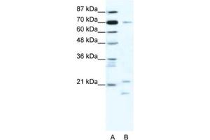 Western Blotting (WB) image for anti-Basic Transcription Factor 3 (BTF3) antibody (ABIN2461626) (BTF3 抗体)