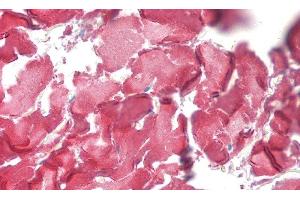 Immunohistochemistry (IHC) image for anti-Collagen, Type I, alpha 1 (COL1A1) (AA 253-471) antibody (ABIN7443395)