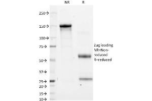 SDS-PAGE Analysis Purified CD11a Mouse Monoclonal Antibody (CRIS-3). (ITGAL 抗体)