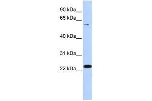 Western Blotting (WB) image for anti-Zinc Finger Protein 460 (ZNF460) antibody (ABIN2459428) (ZNF460 抗体)