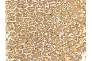 ABIN6255389 and ABIN6267301 at 1/100 staining Rat colon tissue by IHC-P. (EIF2S1 抗体  (pSer51))
