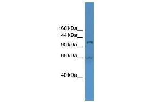 UBA6 antibody used at 0. (UBA6 抗体  (Middle Region))