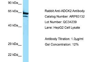 Western Blotting (WB) image for anti-AarF Domain Containing Kinase 2 (ADCK2) (C-Term) antibody (ABIN970062) (ADCK2 抗体  (C-Term))