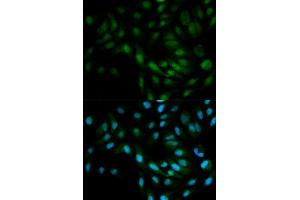 Immunofluorescence analysis of MCF7 cell using MAPK7 antibody. (MAPK7 抗体  (AA 1-310))