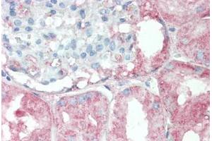 Immunohistochemistry (IHC) image for anti-Ribosomal Protein S6 Kinase, 52kDa, Polypeptide 1 (RPS6KC1) (AA 231-280) antibody (ABIN2879415)